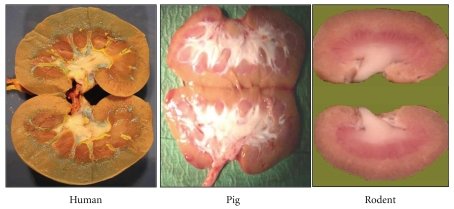 Renal anatomical comparisons between human, pig, and rodents.